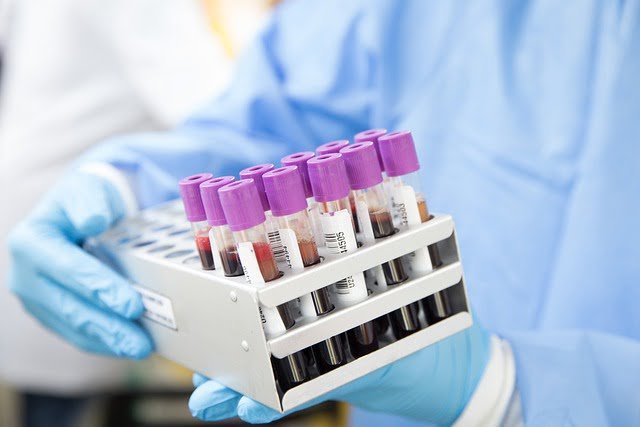 Podstawowe Badania Laboratoryjne Krwi — Kiedy Warto Je Wykonać 3107